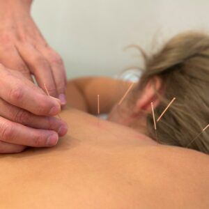 EDOH4500Z – 
Acupuncture (with Photo)